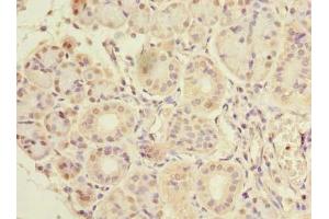 Immunohistochemistry of paraffin-embedded human pancreatic tissue using ABIN7147772 at dilution of 1:100 (CCDC108 antibody  (AA 2-164))