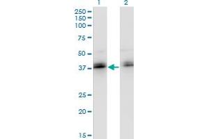 Western Blot analysis of ZNF444 expression in transfected 293T cell line by ZNF444 monoclonal antibody (M02), clone 4E9. (ZNF444 antibody  (AA 38-133))