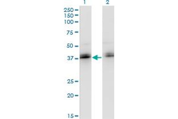 ZNF444 Antikörper  (AA 38-133)
