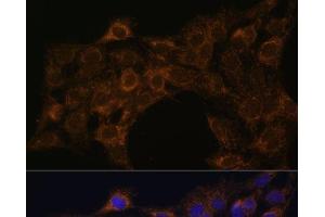 Immunofluorescence analysis of C6 cells using FoxO3a Polyclonal Antibody at dilution of 1:100. (FOXO3 antibody)