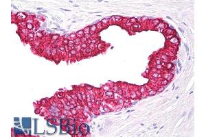 Immunohistochemistry staining of human prostate (paraffin section) using anti-cytokeratin 5+18 (clone). (Keratin 5/8 antibody)