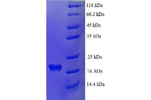 DEFB124 Protein (AA 23-71) (His-SUMO Tag)