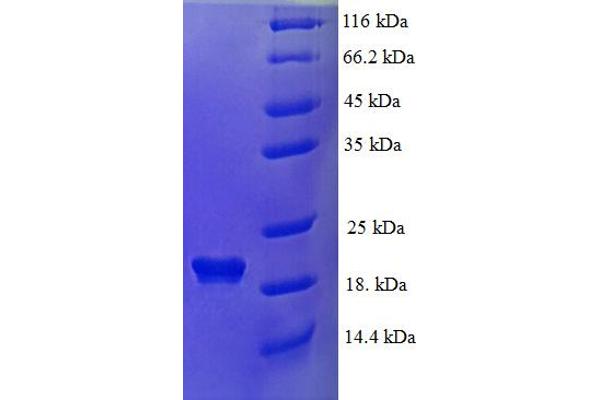 DEFB124 Protein (AA 23-71) (His-SUMO Tag)