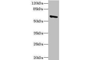 Western blot All lanes: SOCS5 antibody IgG at 1. (SOCS5 antibody  (AA 1-270))