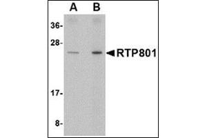 Western blot analysis of RTP801 in human kidney tissue lysate with this product at (A) 0. (DDIT4 antibody  (Center))