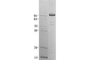Validation with Western Blot (XPNPEP1 Protein (Transcript Variant 2) (His tag))