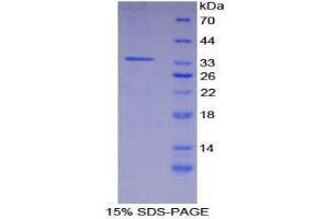 SDS-PAGE (SDS) image for Caspase Recruitment Domain Family, Member 9 (CARD9) (AA 274-530) protein (His tag) (ABIN2124260)