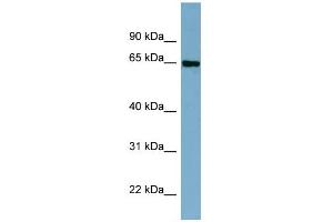 WB Suggested Anti-CBFA2T2 Antibody Titration:  0. (CBFA2T2 antibody  (Middle Region))