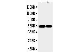 Western Blotting (WB) image for anti-Friend Leukemia Virus Integration 1 (FLI1) (AA 54-73), (N-Term) antibody (ABIN3043998)