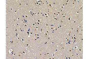 ABIN7097120 and ABIN7101188 at 1/100 staining mouse brain tissue by IHC-P.