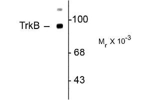 Western Blot of Rabbit Anti-TrkB Antibody Western Blot of Rabbit anti-TrkB antibody.