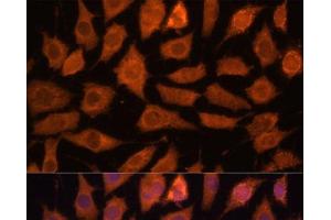 Immunofluorescence analysis of L929 cells using LGMN Polyclonal Antibody at dilution of 1:100 (40x lens). (LGMN antibody)