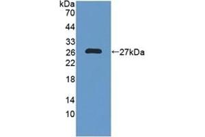 Detection of Recombinant NXN, Human using Polyclonal Antibody to Nucleoredoxin (NXN) (NXN antibody  (AA 166-327))