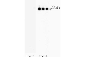 Western blot analysis of EGF Receptor (pY845) in human epidermis.