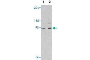Western blot analysis of human heart tissue with LZTR1 polyclonal antibody  at (Lane 1) 1 and (Lane 2) 2 ug/mL dilution. (LZTR1 antibody  (N-Term))