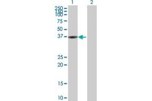 Western Blot analysis of BLVRA expression in transfected 293T cell line by BLVRA MaxPab polyclonal antibody. (Biliverdin Reductase antibody  (AA 1-296))