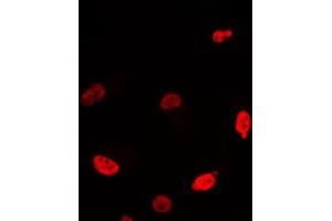 Immunofluorescent analysis of c-Myc staining in Jurkat cells. (c-MYC antibody  (C-Term))