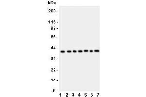 Western blot testing of ARA9 antibody and Lane 1:  HeLa;  2: COLO320;  3: HT1080;  4: MCF-7;  5: SW620;  6: U87;  7: MM231;  Predicted/Observed size: 37KD (AIP antibody  (AA 91-330))