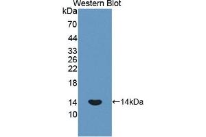 Detection of Recombinant PLOD1, Human using Polyclonal Antibody to Procollagen Lysine-1,2-Oxoglutarate-5-Dioxygenase 1 (PLOD1) (PLOD1 antibody  (AA 636-727))