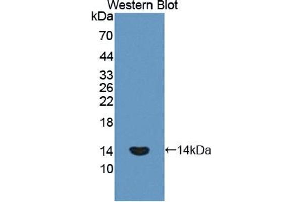 PLOD1 抗体  (AA 636-727)