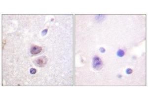Immunohistochemistry (IHC) image for anti-Mitogen-Activated Protein Kinase 14 (MAPK14) antibody (ABIN1847988) (MAPK14 antibody)