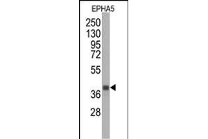 Western blot analysis of anti-EPHA5 Monoclonal Antibody (ABIN387809 and ABIN2843902) by EPHA5 recombinant protein (Fragment).
