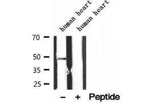 Western blot analysis of extracts of human heart tissue, using ATPB antibody. (ATP5B antibody  (Internal Region))