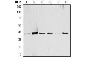 Western blot analysis of ATF1 expression in HeLa (A), KNRK (B), A431 (C), SP2/0 (D), mouse brain (E), H9C2 (F) whole cell lysates. (AFT1 antibody  (C-Term))