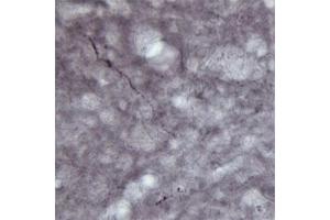 IHC on rat brain (free floating sections) using Rabbit antibody to VGluT1  at a concentration of 30 µg/ml. (SLC17A7 antibody)