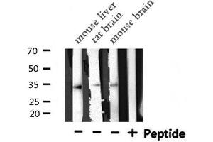 Western blot analysis of STARD10 expression in various lysates (STARD10 antibody  (Internal Region))