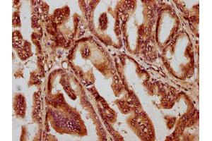 IHC image of ABIN7160302 diluted at 1:1400 and staining in paraffin-embedded human prostate tissue performed on a Leica BondTM system. (AMH antibody  (AA 26-560))