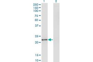 Western Blot analysis of TWIST2 expression in transfected 293T cell line by TWIST2 monoclonal antibody (M06), clone 1E2.