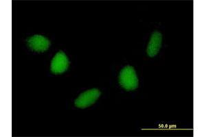 Immunofluorescence of purified MaxPab antibody to NUDT6 on HepG2 cell. (NUDT6 antibody  (AA 1-316))