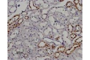Expression of TRPV5 in rat kidney - Immunohistochemical staining of rat kidney paraffin embedded section using Anti-TRPV5 Antibody (ABIN7043855, ABIN7043996 and ABIN7043997), (1:100). (TRPV5 antibody  (C-Term, Intracellular))