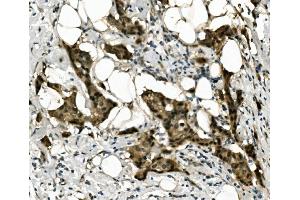 IHC analysis of RBPMS using anti-RBPMS antibody (ABIN7602120). (RBPMS antibody  (AA 6-196))