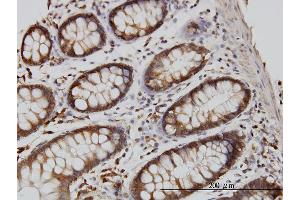 Immunoperoxidase of monoclonal antibody to RGL1 on formalin-fixed paraffin-embedded human colon. (RGL1 antibody  (AA 2-109))