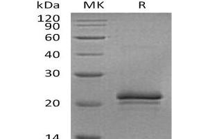 Western Blotting (WB) image for Vascular Endothelial Growth Factor A (VEGFA) protein (ABIN7321249) (VEGFA Protein)