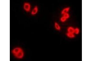 Immunofluorescent analysis of RAB5A staining in Hela cells. (RAB5 antibody)