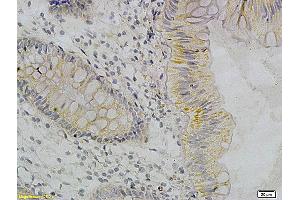 Immunohistochemistry (IHC) image for anti-Tumor Necrosis Factor alpha (TNF alpha) antibody (ABIN722481) (TNF alpha antibody)