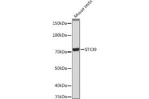 Western blot analysis of extracts of Mouse testis, using STK39 Rabbit mAb (ABIN1682890, ABIN3015922, ABIN3015923 and ABIN7101461) at 1:1000 dilution. (STK39 antibody)