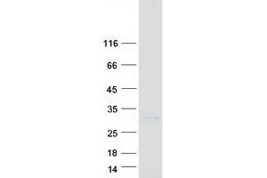 Western Blotting (WB) image for Casein alpha S1 (CSN1S1) (Transcript Variant 1) protein (Myc-DYKDDDDK Tag) (ABIN2714635)