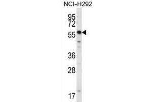 Western Blotting (WB) image for anti-SET and MYND Domain Containing 2a (SMYD2A) antibody (ABIN2995651) (SMYD2A antibody)