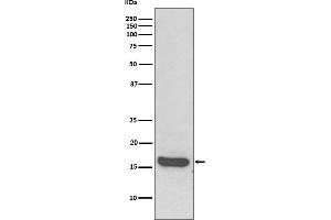 Western blot analysis of MAP1LC3A expression in Human brain lysate. (Recombinant MAP1LC3A antibody)