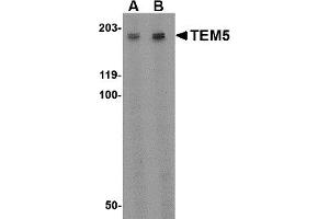 Western Blotting (WB) image for anti-G Protein-Coupled Receptor 124 (GPR124) (Middle Region) antibody (ABIN1031119) (GPR124 antibody  (Middle Region))