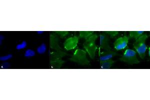 Immunocytochemistry (ICC) image for anti-HLA-DR-gamma (CD74) antibody (ABIN361789)