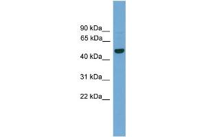 WB Suggested Anti-GRAMD3  Antibody Titration: 0.