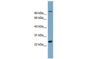SEMA3D antibody used at 1 ug/ml to detect target protein. (SEMA3D antibody  (Middle Region))
