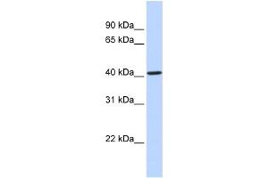 WB Suggested Anti-CYP4F12 Antibody Titration:  0. (CYP4F12 antibody  (Middle Region))