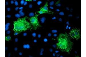 Anti-KATNB1 mouse monoclonal antibody (ABIN2455210) immunofluorescent staining of COS7 cells transiently transfected by pCMV6-ENTRY KATNB1 (RC201852). (KATNB1 antibody)