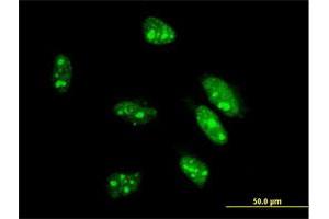 Immunofluorescence (IF) image for anti-Caudal Type Homeobox 1 (CDX1) (AA 126-215) antibody (ABIN514322)
